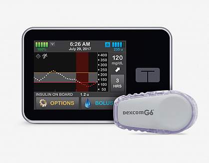 Control-IQ artificial pancreas system