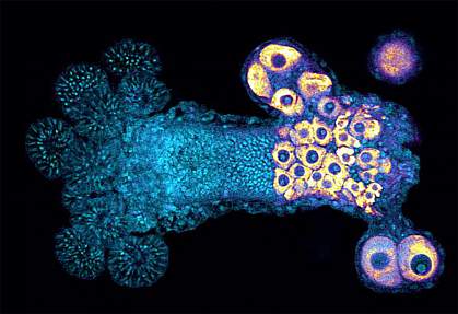 Female Sexual Polyp of Hydractinia