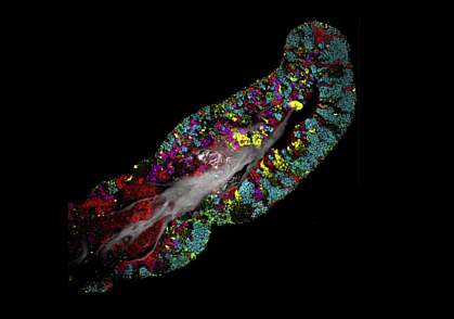 Bacterial consortium from the human tongue