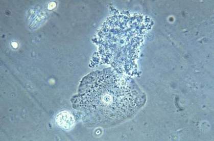 Photomicrograph of vaginal smear specimen