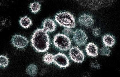 Transmission electron microscope image of novel coronavirus SARS-CoV-2