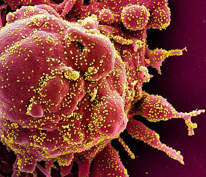 Novel Coronavirus SARS-CoV-2