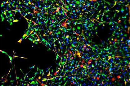 Fluorescent microscope image of neural stem cells maturing