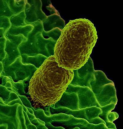 Klebsiella pneumoniae on surface of human neutrophil