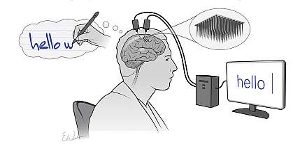 Cartoon of man thinking about writing a sentence while electrodes implanted into his brain send a signal that appears as words on a computer screen