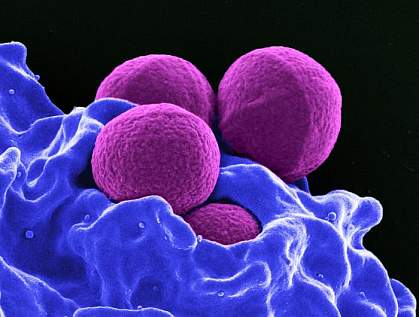 MRSA bacteria