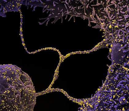 Novel Coronavirus SARS-CoV-2