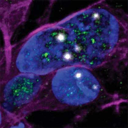 Bright white spots in nuclei with TDP-43 knockdown