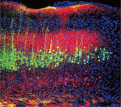 Neurons in a mouse brain’s auditory cortex