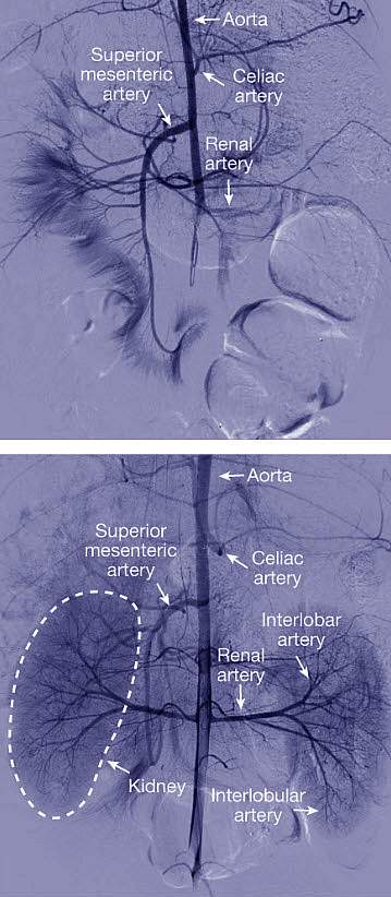 Small blood vessels appear after treatment with OrganEx, but not with the standard machine