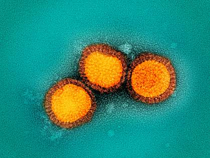 Colorized electron micrograph of three round virus particles