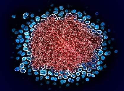 Numerous HIV particles surrounding a cell, with some emerging from it