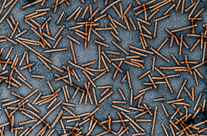 Transmission electron micrograph of numerous thin, rod-like Photorhabdus virulence cassettes