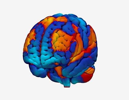 Illustration of a brain with different regions in different colors.