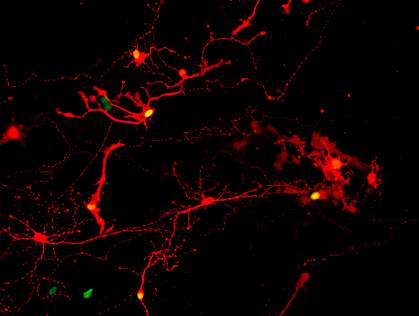 Retinal neurons glowing red, some with green nuclei