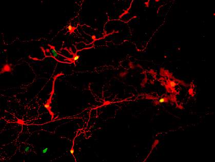 Retinal neurons glowing red, some with green nuclei