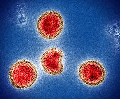 Colorized electron micrograph of circular influenza B virus particles