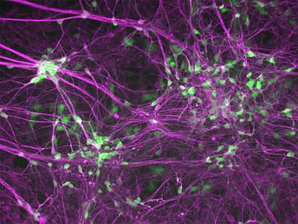 Human induced motor neurons.