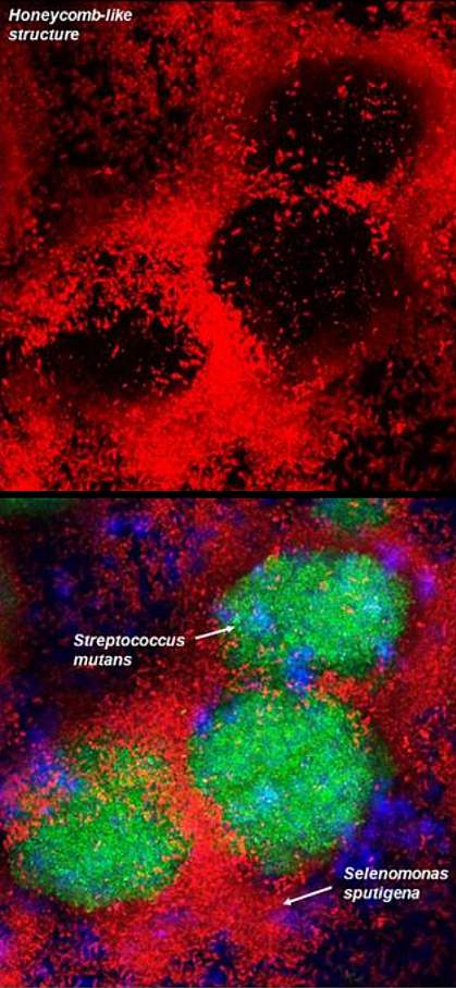 One panel shows a honeycomb-like structure in red made of Selenomonas sputigena. The other panel shows Streptococcus mutans, in green, filling the gaps in the structure.