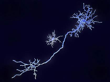 Microglial cell near the long stalk of a neuron.