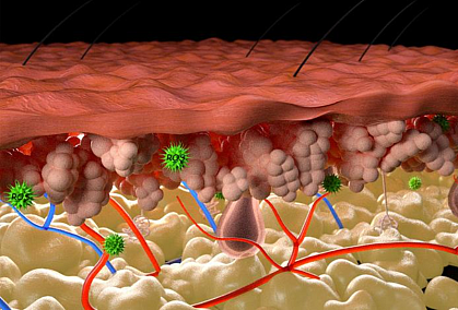 Illustration of inflamed skin shows layers affected by reactive oxygen species.