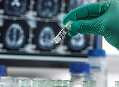 Gloved hand holding a test tube with brain images in background