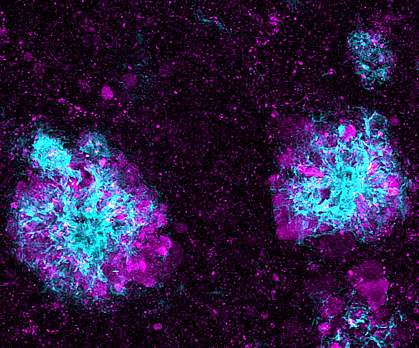 Immunofluorescence image of purple clusters around loose light blue clusters.
