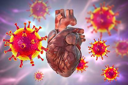 人体心脏被放大的SARS-CoV-2病毒包围的图示。