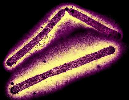 Transmission electron micrographs of three rod-shaped virus particles that have been inverted, repositioned, and colorized.