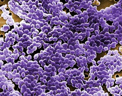 Digitally colorized scanning electron microscopic image showing large field of Enterococcus bacteria.