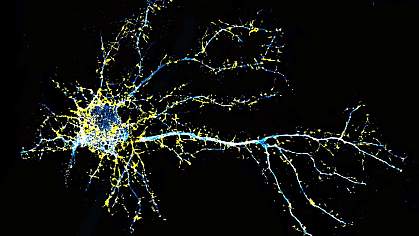 Fluorescence microscopy image of a cortical neuron.