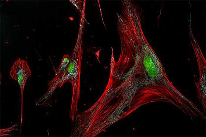 Microscope image of long cells with visible fibers inside.