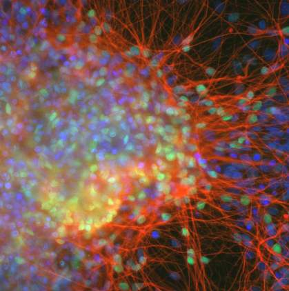 Cortical neurons derived from iPS cells.