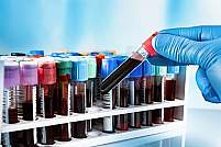 Gloved hand holding a test tube with a blood sample.