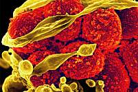 耐甲氧西林金黄色葡萄球菌（MRSA）细菌