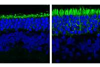 Side-by-side images show untreated, shorter rod photoreceptors next to longer rods treated with reserpine.