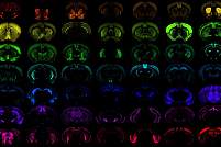 Images of brains