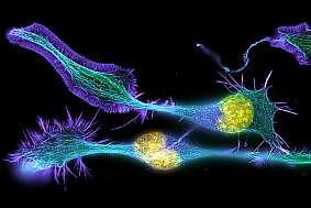 Developing nerve cells.