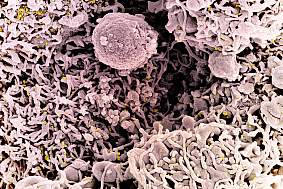 Colorized scanning electron micrograph of a cell (pink) infected with a variant strain of SARS-CoV-2 virus particles (UK B.1.1.7; gold), isolated from a patient sample.