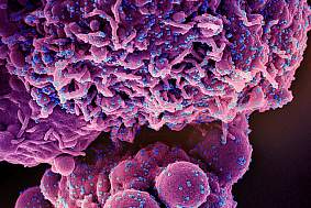 Novel Coronavirus SARS-CoV-2 (Omicron)