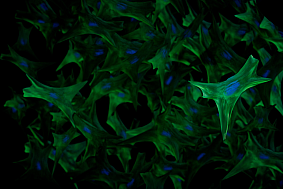 Genomic variation in the STAT4 gene causes disorganized fibroblasts that fail to heal wounds properly. The nuclei of the fibroblasts are shown in blue. 