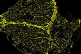 Imagine of florescent staining of the blood vessels in the brain’s dura mater.