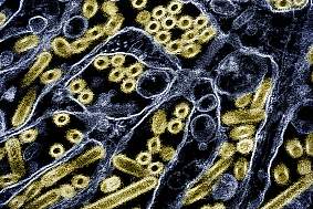 The image shows a colorized image of gold avian influenza H5N1 virus particles grown in blue Madin-Darby Canine Kidney epithelial cells.