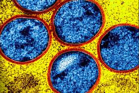 Microscopic image of immature mpox virus spheres.