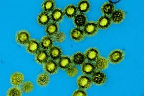 Colorized transmission electron micrograph of influenza A/H1N1 virus particles. 