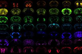 Multiple images of the mouse brain on a black background with various cells highlighted to portray the precision access of new genetic tools developed. 
