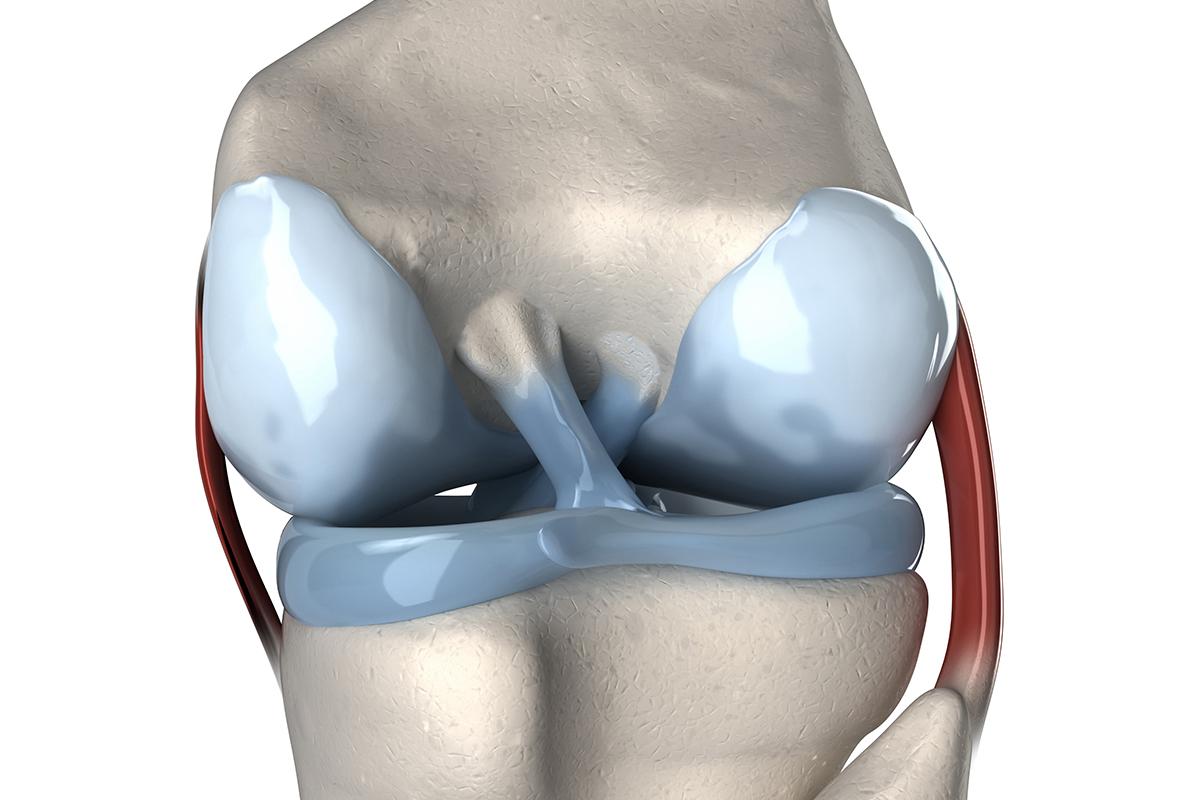 Knee joint illustration. The thigh bone (top bone) is connected to the shin bone (larger of the two bottom bones) by ligaments.