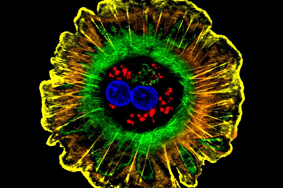 Single human liver cell on a black background