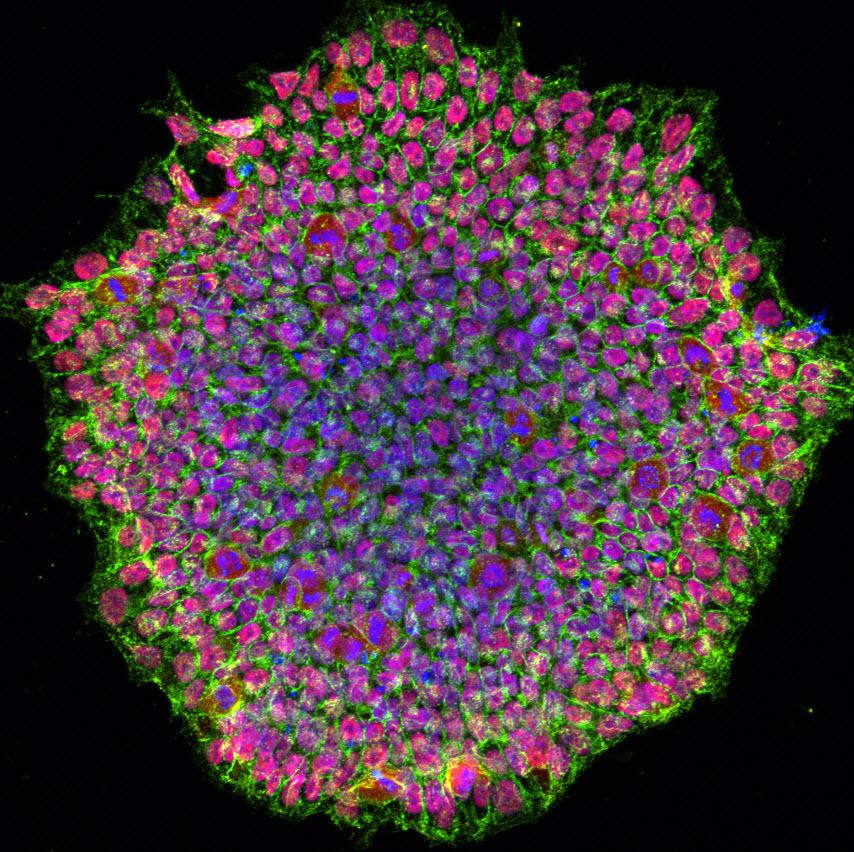 NIH researchers develop first stem cell model of albinism to study ...