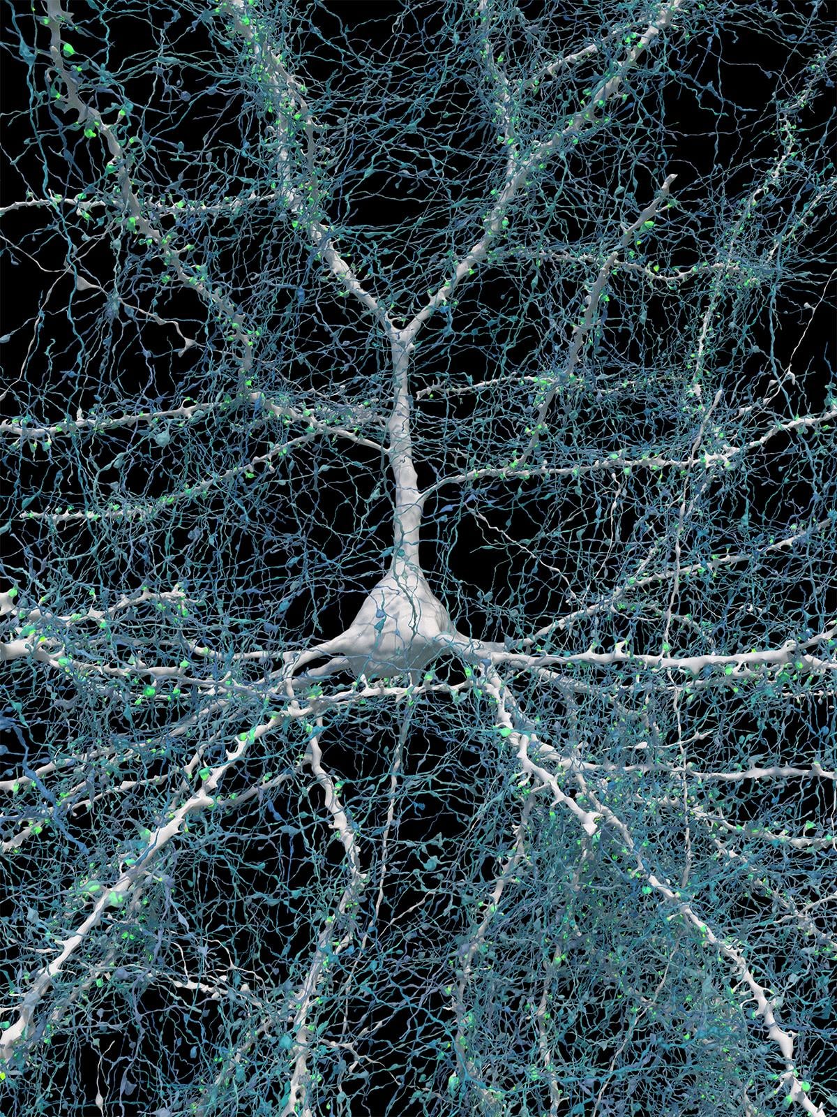 Unseen details of human brain structure revealed | National Institutes ...